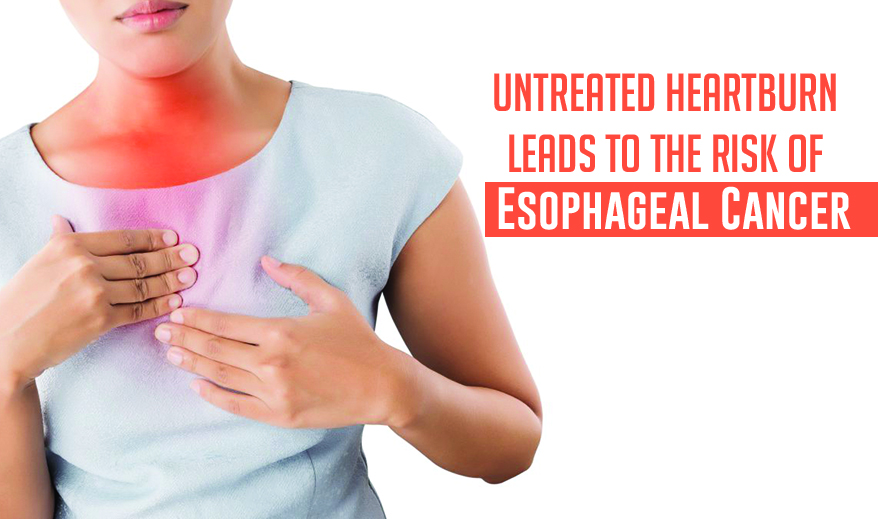 esophageal cancer treatment